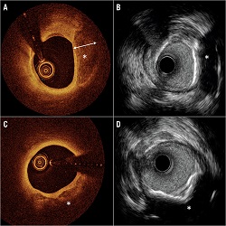 Optical Coherence Tomography (OCT) Applications :: Ophthalmology and Vision Science