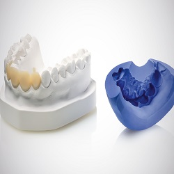 Advancements in Dental Materials and Techniques :: Advanced Dental and Oral Health