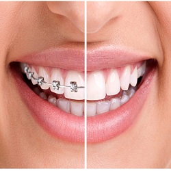 Orthodontics :: Advanced Dental and Oral Health