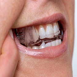 Oral Appliance Therapy :: Advanced Dental and Oral Health