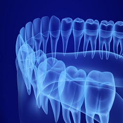 3-D Imaging in Dentistry :: Advanced Dental and Oral Health