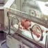 Neonatal Intensive Care :: Advanced Pediatrics and Neonatology