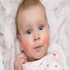 Pediatric Dermatology :: Advanced Pediatrics and Neonatology