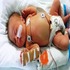 Neonatal Infections and Prevention :: Advanced Pediatrics and Neonatology