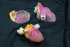 3D Printing for Surgical Planning :: Nephrology & Urology