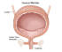 Biomarkers for Early Detection in Kidney & Bladder Diseases :: Nephrology & Urology