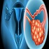 Gynaecologic Oncology :: Gynecology and Women's Health