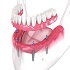Implant Prosthetics & Rehabilitation :: Advanced Dental and Oral Health