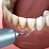 Periodontal Therapy & Disease Management :: Advanced Dental and Oral Health