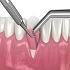 Aesthetic Soft Tissue Surgery :: Advanced Dental and Oral Health