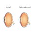 Retina and Retinal Detachment :: Ophthalmology and Vision Science