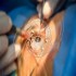 Ophthalmology Surgery :: Ophthalmology and Vision Science