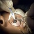 Refractive Surgery :: Ophthalmology and Vision Science