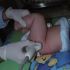 Pediatric Orthopedics :: Advanced Pediatrics and Neonatology